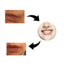 Resultados dos Adesivos SkinRenew™ antes e depois, evidenciando a redução de rugas e pele mais lisa.